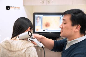 What is Mole Mapping - Erina Skin Cancer Clinic